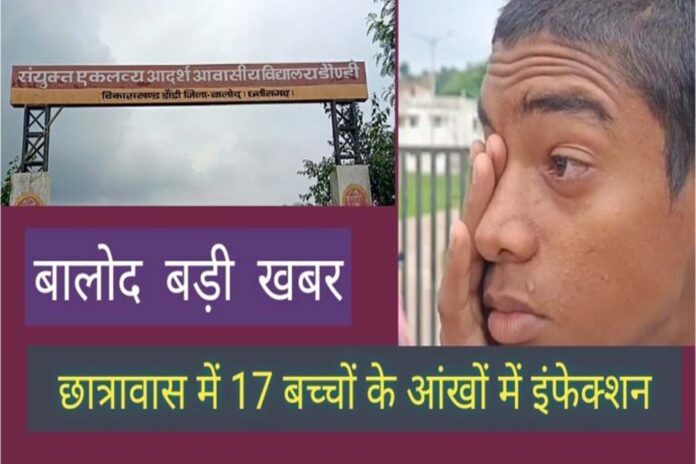 Chhattisgarh: डौंडी छात्रावास के 17 बच्चों की आंखों में इंफेक्शन से मचा हड़कंप, जाने क्या है पूरा मामला...