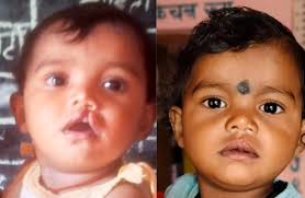 download (2) शासन की योजना से दूर हुई बेटी के भविष्य की चिंता, चिरायु दल ने लौटाई मासूम रंजना की मुस्कान