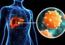 मुंगेली : हेपेटाइटिस बी-सी उन्मूलन : जिला स्तरीय कार्यशाला आयोजित मुंगेली : हेपेटाइटिस बी-सी उन्मूलन : जिला स्तरीय कार्यशाला आयोजित