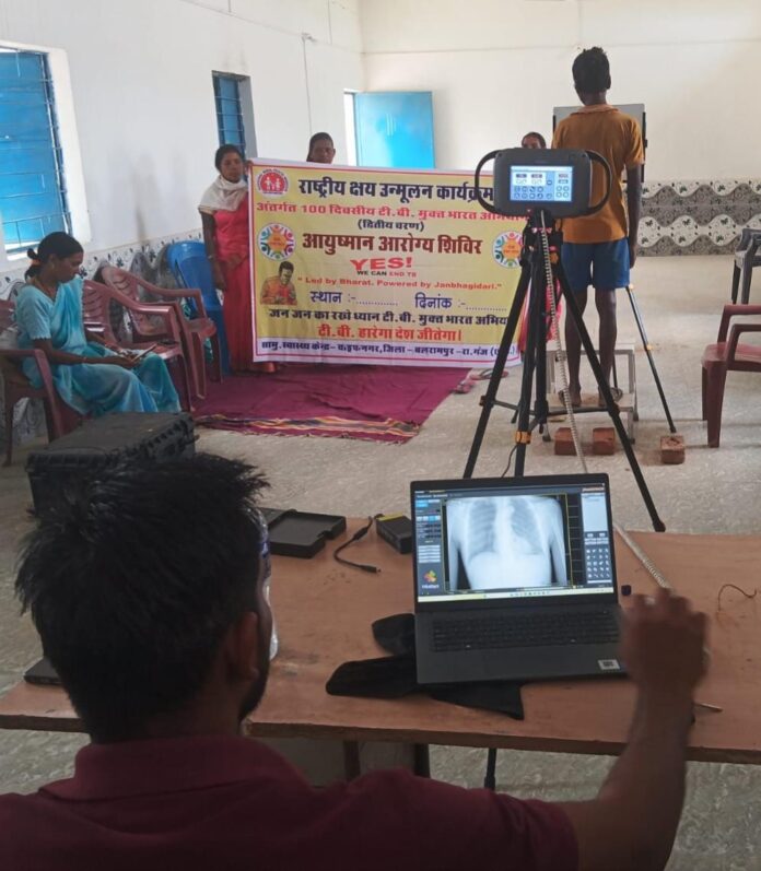 download (2) अत्याधुनिक हैंड हेल्ड एक्स-रे तकनीक से तेज हुई टीबी मरीजों की पहचान